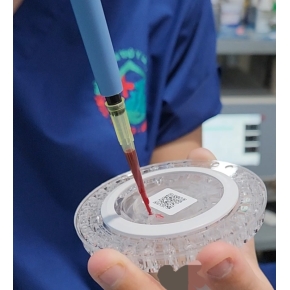 Siêu âm và Xét nghiệm