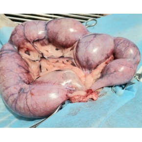 Hình ảnh phẫu thuật tại Phòng khám