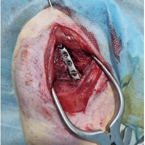 Hình ảnh phẫu thuật tại Phòng khám