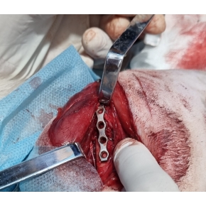 Hình ảnh phẫu thuật tại Phòng khám