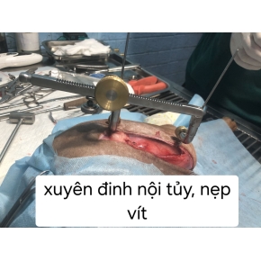 Hình ảnh phẫu thuật tại Phòng khám