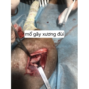 Hình ảnh phẫu thuật tại Phòng khám