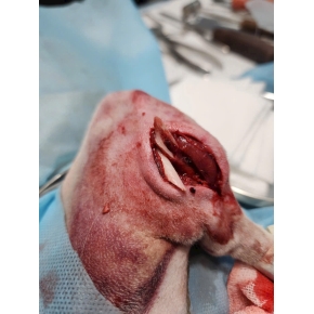 Mổ chỉnh hình gãy xương cho bé tại phòng khám