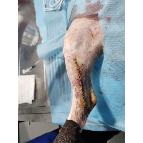 Mổ gãy xương chó