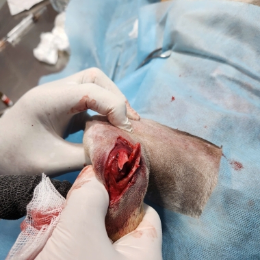 Mổ gãy xương chó